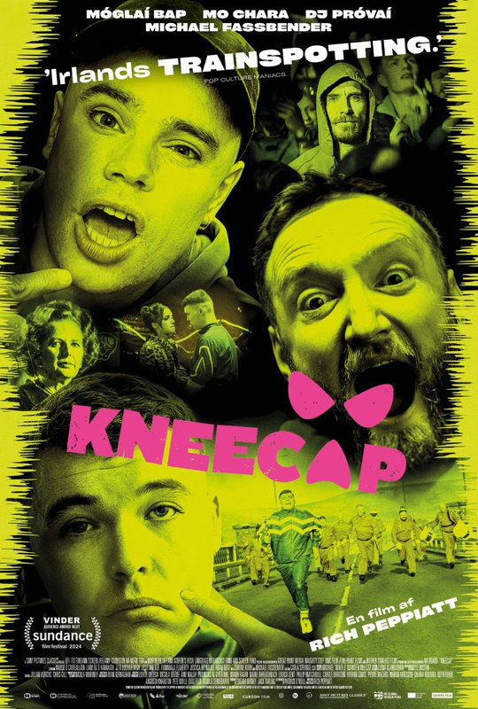 Kneecap